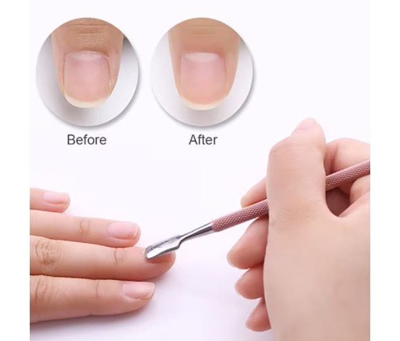 Moyra Cuticule Remover