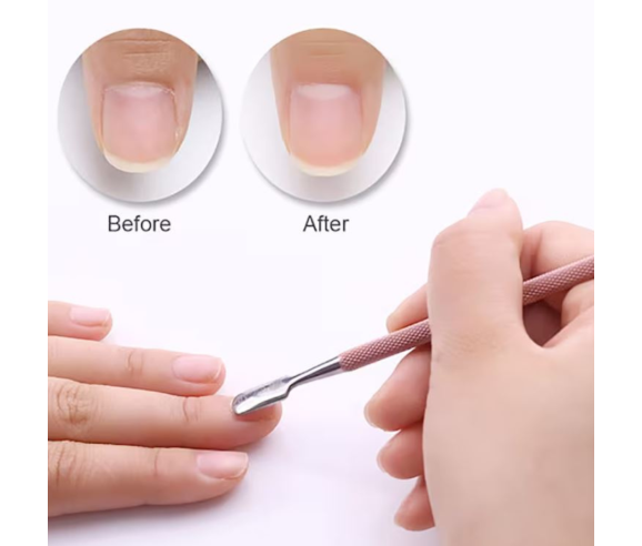 Moyra Cuticule Remover